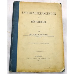 Knochenerkrankungen